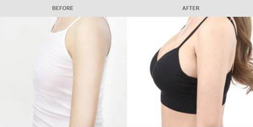 刘世铭医生口碑如何?乳房整形技术如何?