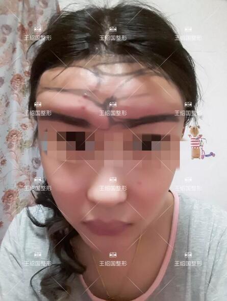 【王绍国案例】——别把健康当做儿戏~