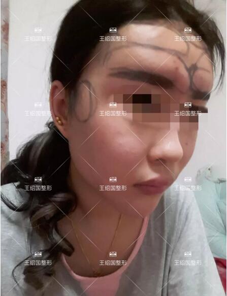 【王绍国案例】——别把健康当做儿戏~