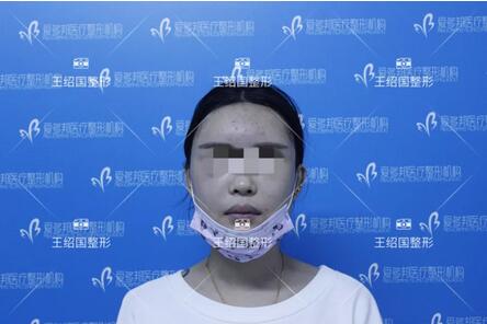 【王绍国案例】——别把健康当做儿戏~