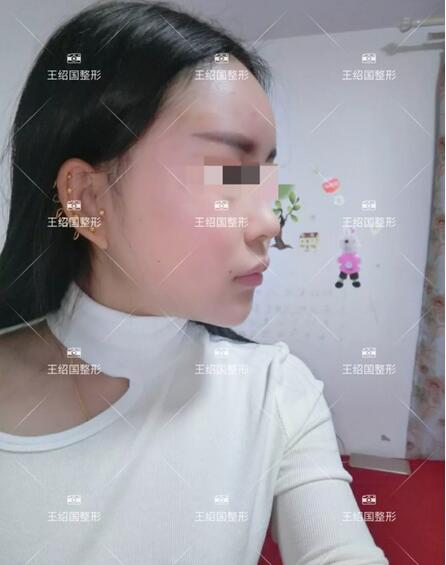 【王绍国案例】——别把健康当做儿戏~