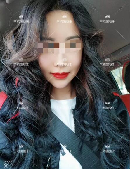 【王绍国案例】——别把健康当做儿戏~