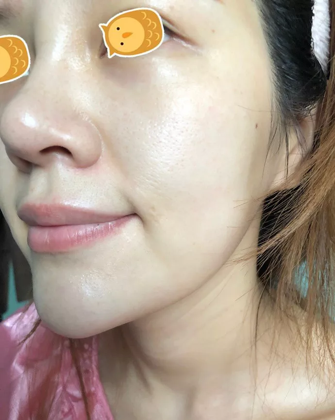 打完丽珠兰水光补水，30岁的她迎来了婴儿般逆天的肌肤！