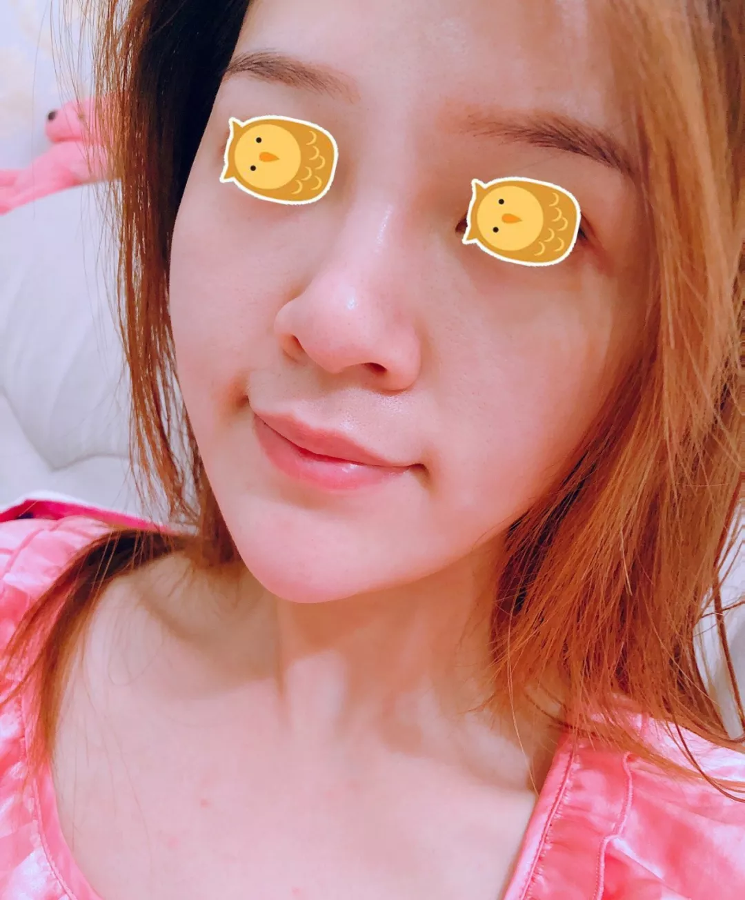 打完丽珠兰水光补水，30岁的她迎来了婴儿般逆天的肌肤！