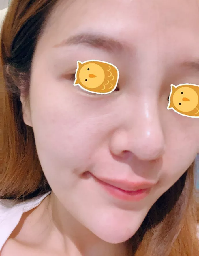打完丽珠兰水光补水，30岁的她迎来了婴儿般逆天的肌肤！