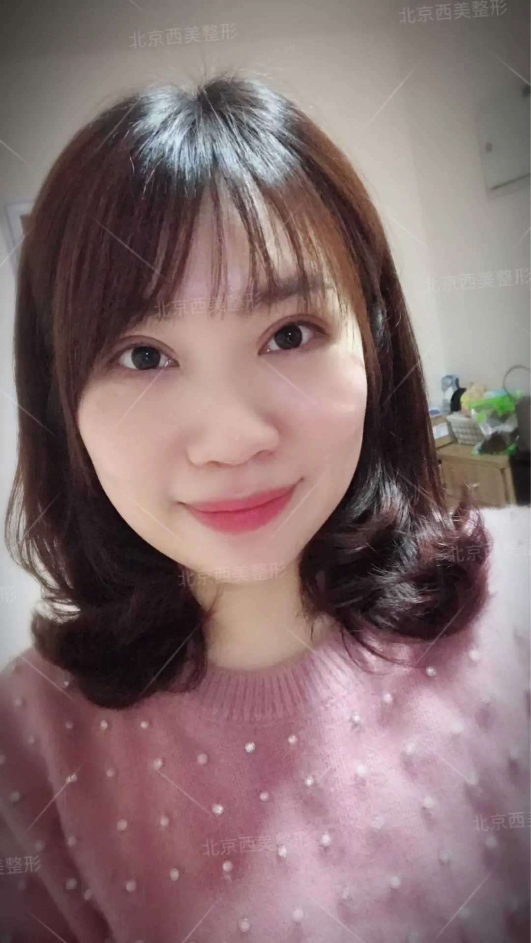 谢双灵案例有吗？谢双灵双眼皮真实记录——伊美尔健翔医院