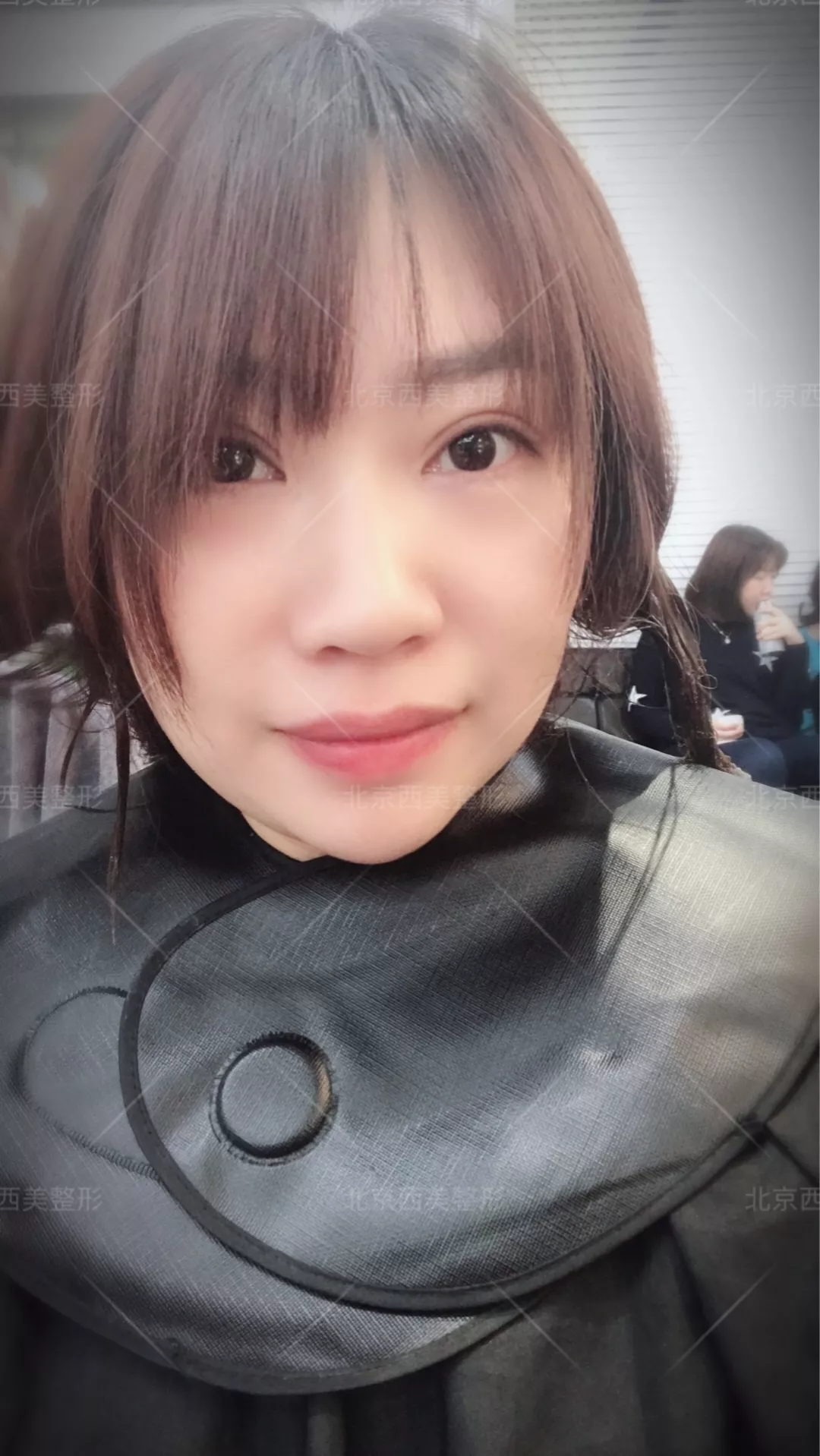 谢双灵案例有吗？谢双灵双眼皮真实记录——伊美尔健翔医院