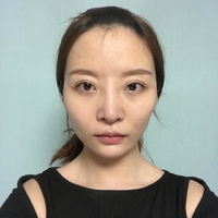 宁波尚丽整形美容医院怎么样?都有哪些知名案例?