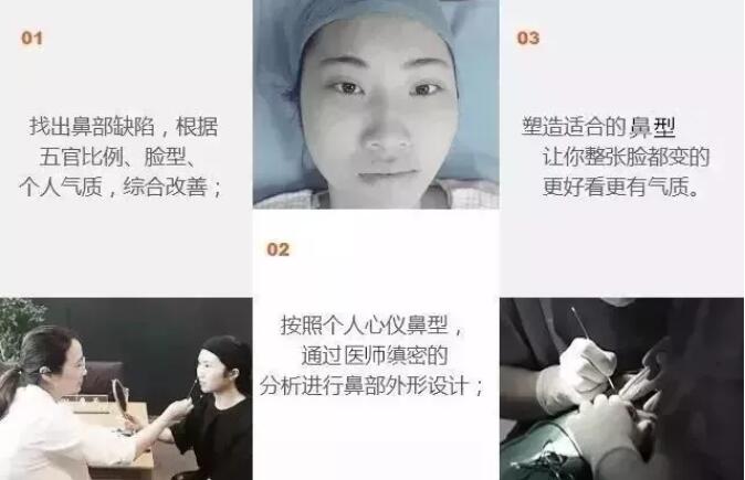 薇琳医美狄峰在鼻整形手术案例赛中荣获******名金刀奖！！