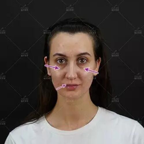 徐赤宇美莱光影艺术面雕真实经历分享，俄罗斯镁铝的蜕变~