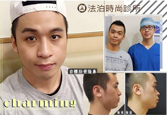 西昌整形专家汤颖峰