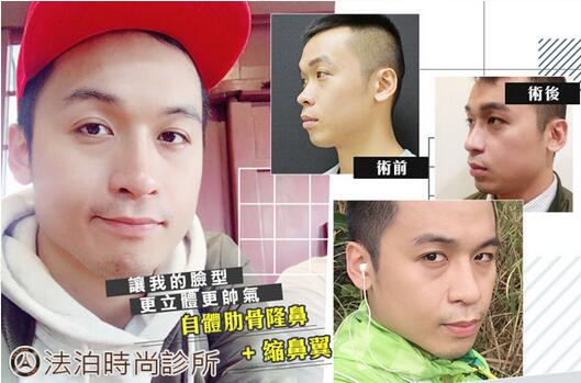 西昌整形专家汤颖峰