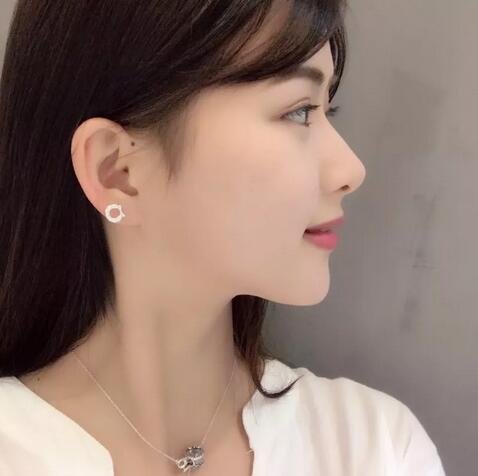 江门华美王文仿生隆鼻做得咋样喃？这里有一则案例哟！