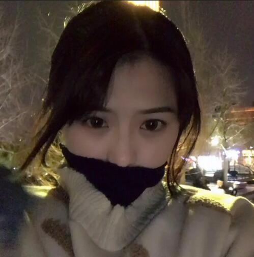 江门华美王文仿生隆鼻做得咋样喃？这里有一则案例哟！