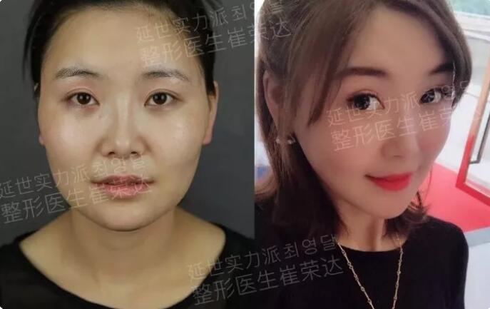 拍照比个V已经out了，这个V才较in~