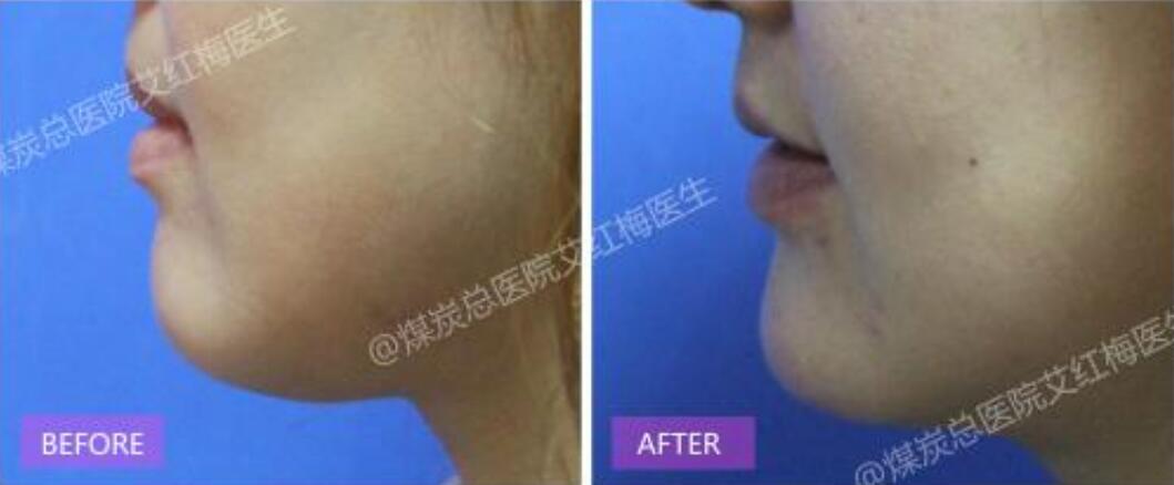 艾红梅口碑如何?煤炭总院为你解答