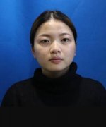 西之米整形医院5s重睑术真实案例对比：单眼皮的烦恼 width=