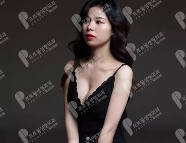 妙桃琴面假体隆胸术后恢复手记——平胸妹子的逆袭之旅~