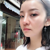 下巴吸脂恢复过程图片分享，从此告别双下巴