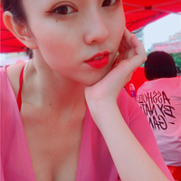 全切去皮去脂双眼皮恢复全过程分享，两个月后的我美美哒~~~