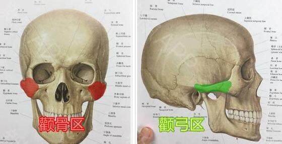 颧骨内推好吗?听起来有点危险呢?