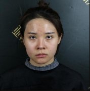 付国友削骨瘦脸价格公布|156天削骨手术前后对比图一览 width=