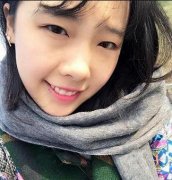 5S重睑术前后对比皂片案例：79天改变单眼皮肌无力 width=