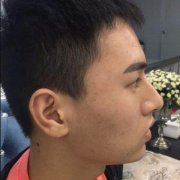垫下巴前后对比图：男人也可以垫下巴! width=