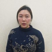 奇致整形美容医院双眼皮修复43天前后对比图皂片 width=