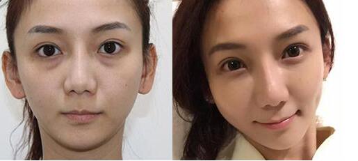 张润伟医生较擅长什么技术?口碑如何?