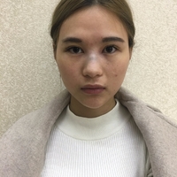 陈柏森医生做面部除皱项目技术如何?能让我恢复年轻状态吗?