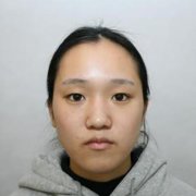 亚韩割双眼皮多少钱?割双眼皮前后对比图花了1万6 width=
