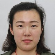 上海华美开双眼皮前后对比图：真人案例分享哟~ width=