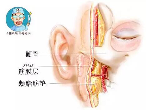 这些项目虽然火，但还是不要做了：取颊脂肪垫~