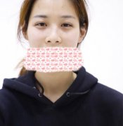 北京隆鼻梁前后对比图：不看过程不知道变了 width=
