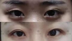盘点大小眼的案例才发现，80%的人都在遭遇这3个问题！ width=