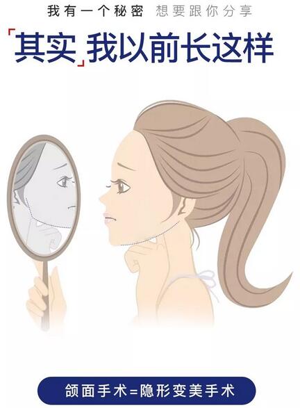 都知道改脸，你知道改脸改的是什么吗？