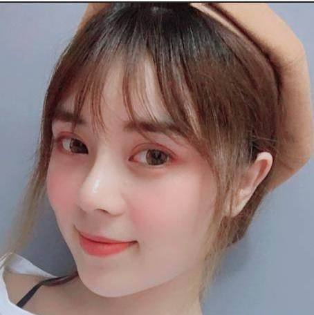 麻麻米亚隆鼻真实案例分享，内附恢复果图