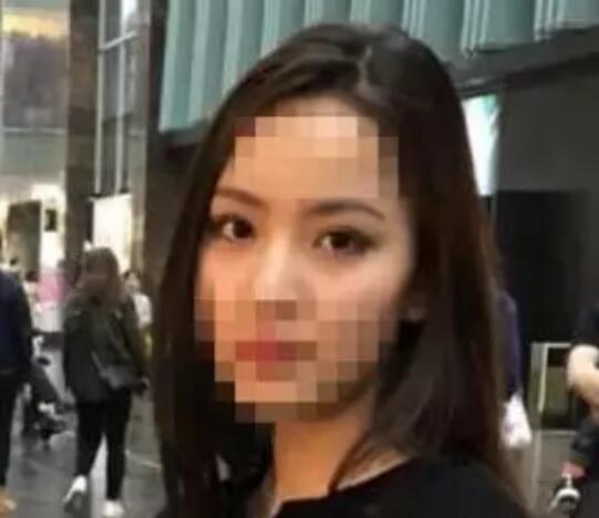 抽大腿脂肪填充到脸上，3个月恢复像我现在这样，不会看起来凶凶的~