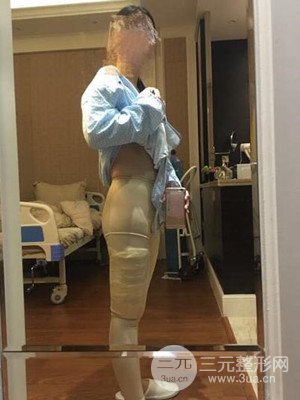 周栩医生做体型塑形技术怎么样?能否让我拥有身材?