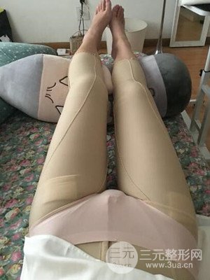 周栩医生做体型塑形技术怎么样?能否让我拥有身材?