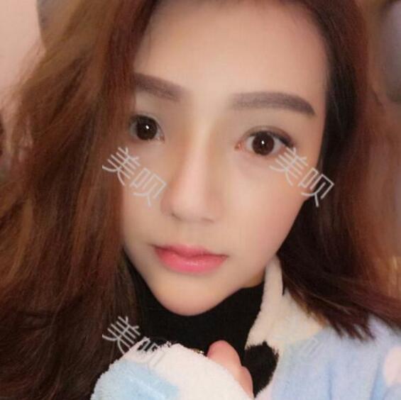 水滴鼻好看吗?我想去做个水滴鼻~~