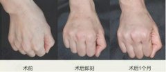 除了脸，这个地方更能暴露你的衰老~ width=