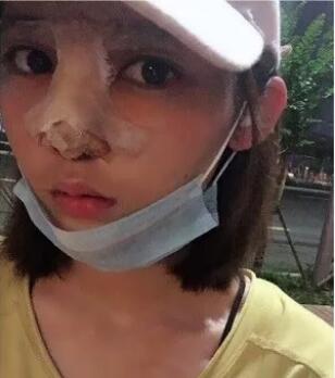 赵博士整形医院做鼻部手术技术怎么样?能让我拥有一个好看的鼻子吗?