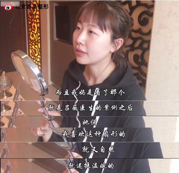 北京西美整形吕薇双眼皮案例又来一则，接住！