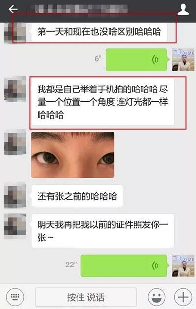 北京西美整形吕薇双眼皮案例又来一则，接住！