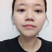 穆林医生做去眼袋技术如何?能值得相信吗?