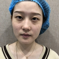 赵小忠祛斑技术如何?我也想拥有美白肌肤!