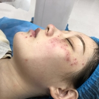 赵小忠祛斑技术如何?我也想拥有美白肌肤!