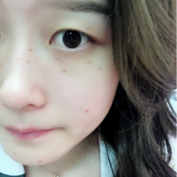 赵小忠祛斑技术如何?我也想拥有美白肌肤!